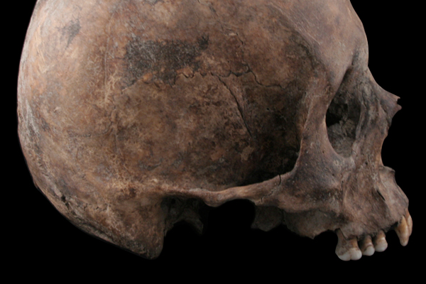 side profile of human skull