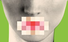 Illustration of face with mouth pixelated out.