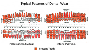 Edwards' diagram of the typical wear patterns for Prehistoric and Historic individuals, indicating how wear has changed over time.